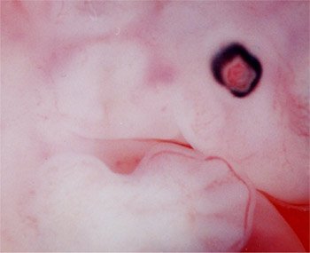 Description : Embryon de 41 jours: une main et un oeil pigmenté